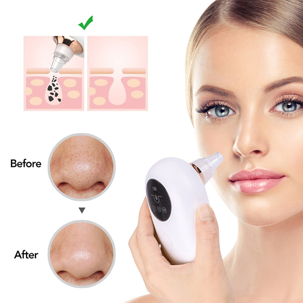 Portable  Face Deep Pore Cleaner Vacuum and Blackhead Remover